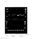 Fig. 02 - NOVEL METHODS OF DIFFERENTIATING YEAST STRAINS AND/OR DETERMINING GENETIC STABILITY OF YEAST STRAINS, AND USES THEREOF