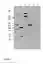 Fig. 04 - Methods for determining the presence or absence of elite event RF-BN1 in plant material