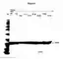 Fig. 07 - Modified Human Growth Hormone