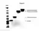 Fig. 10 - Modified Human Growth Hormone