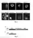 Fig. 03 - SYSTEM FOR DETECTNG PROTEASE