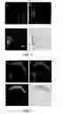 Fig. 04 - SYSTEM FOR DETECTNG PROTEASE