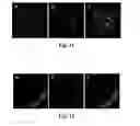 Fig. 16 - SYSTEM FOR DETECTNG PROTEASE
