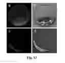 Fig. 17 - SYSTEM FOR DETECTNG PROTEASE