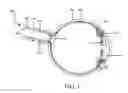 Fig. 02 - METHOD OF TREATING GLAUCOMA AND INTRAOCULAR HYPERTENSION