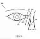 Fig. 07 - METHOD OF TREATING GLAUCOMA AND INTRAOCULAR HYPERTENSION