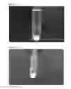 Fig. 07 - PHARMACEUTICAL COMPOSITIONS COMPRISING TGF-BETA 1 INHIBITOR PEPTIDES