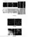 Fig. 02 - TERMINALLY-DIFFERENTIATED ANUCLEATE PLATELET PROGENY GENERATION
