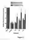 Fig. 02 - METHODS FOR TREATING LOWER URINARY TRACT DISORDERS USING alpha2delta SUBUNIT CALCIUM CHANNEL MODULATORS WITH SMOOTH MUSCLE MODULATORS