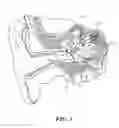 Fig. 02 - Implantable Inner Ear Drive System