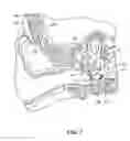 Fig. 03 - Implantable Inner Ear Drive System