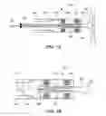 Fig. 04 - Implantable Inner Ear Drive System