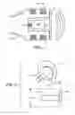 Fig. 05 - Implantable Inner Ear Drive System