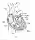 Fig. 02 - Devices, systems, and methods for reshaping a heart valve annulus, including the use of a bridge implant having an adjustable bridge stop