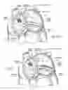 Fig. 06 - Devices, systems, and methods for reshaping a heart valve annulus, including the use of a bridge implant having an adjustable bridge stop