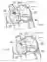 Fig. 07 - Devices, systems, and methods for reshaping a heart valve annulus, including the use of a bridge implant having an adjustable bridge stop