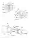 Fig. 32 - Devices, systems, and methods for reshaping a heart valve annulus, including the use of a bridge implant having an adjustable bridge stop