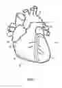 Fig. 02 - DEVICE AND METHOD OF USE FOR FUNCTIONAL ISOLATION OF ANIMAL OR HUMAN TISSUES