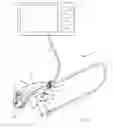 Fig. 02 - Endoscope bending section control mechanism