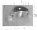 Fig. 07 - Stereoscopic coupler for mechanically and optically coupling a stereo endoscope to a stereo endoscopic camera