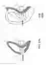 Fig. 07 - Biologic information detecting apparatus
