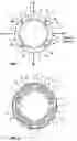 Fig. 02 - Balloon of a balloon catheter