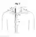 Fig. 09 - Central venous access system