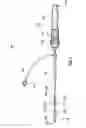 Fig. 02 - Catheter assembly with prosthesis crimping and prosthesis retaining accessories