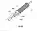 Fig. 43 - Catheter assembly with prosthesis crimping and prosthesis retaining accessories