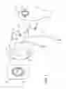 Fig. 02 - STOMA SUPPORT PLATE AND HARNESS