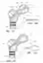 Fig. 09 - PROXIMAL FEMUR FIXATION APPARATUS, SYSTEMS AND METHODS WITH ANGLED ELONGATE ELEMENTS