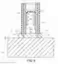 Fig. 09 - Implantation system for tissue repair