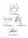 Fig. 02 - KNEE RECONSTRUCTION PROCEDURE AND SURGICAL IMPLEMENT PARTICULARLY USEFUL FOR SUCH KNEE RECONSTRUCTION PROCEDURE