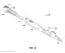 Fig. 02 - Intraocular lens insertion devices
