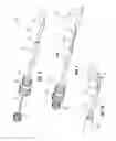 Fig. 03 - Blood filter retrieval devices and methods