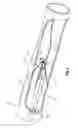 Fig. 05 - Blood filter retrieval devices and methods
