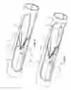 Fig. 13 - Blood filter retrieval devices and methods