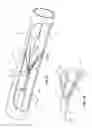Fig. 14 - Blood filter retrieval devices and methods