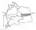 Fig. 01 - Methods and systems for increasing the bending stiffness and constraining the spreading of a spinal segment