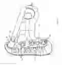 Fig. 02 - Bone plate with pre-assembled drill guide tips