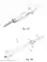 Fig. 35 - Method and apparatus for performing spinal surgery