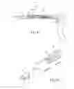 Fig. 43 - Method and apparatus for performing spinal surgery
