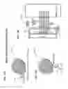 Fig. 11 - Laser-based nerve stimulators for, E.G., hearing restoration in cochlear prostheses and method