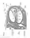 Fig. 24 - Laser-based nerve stimulators for, E.G., hearing restoration in cochlear prostheses and method