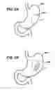 Fig. 08 - Systems and Methods For Regulating Metabolic Hormone Producing Tissue