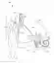Fig. 01 - Cochlear lead