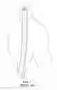 Fig. 02 - Abdominal Aortic Stent