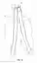Fig. 07 - Abdominal Aortic Stent