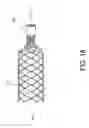 Fig. 09 - Stent With Reduced Weld Profiles and a Closed-End Wire Configuration