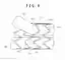 Fig. 07 - Stent